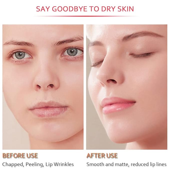 20Pcs Moisturizing Restores Moisture Lip Mask for Dry Lips and Lip Lines Overnight Lip Care, Gel Treatment Plumping Lips Mask (Red)-Velvo Beauty