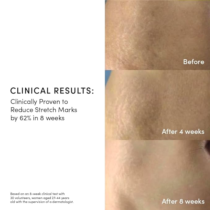 Evereden Golden Belly Serum, 1.7 fl oz. | Clean & Vegan Women's Belly Oil for Pregnancy and Postpartum | Clean Maternity Skincare | Non-Toxic Stretch Mark Oil-Velvo Beauty