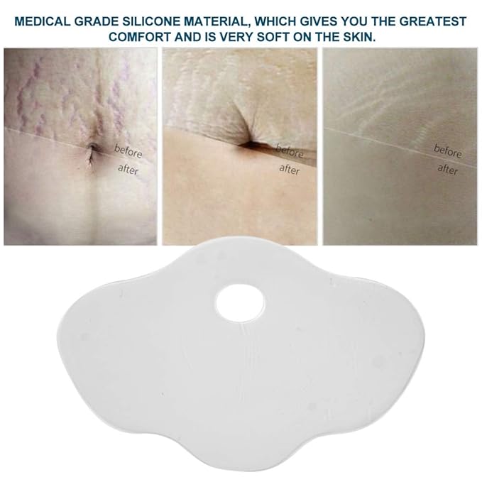 Reusable Silicone Anti-Wrinkle Belly Scar stickers Stomach Pads cover Stickers Stretch Marks Removal Skin Care-Velvo Beauty