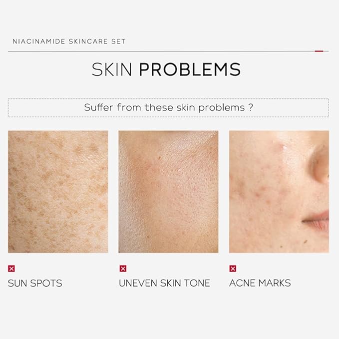 Niacinamide Skincare Set: 4pcs Beauty Kit with Cleanser, Toner, Serum, & Facial Cream - Hydrates & Evens Skin Tone - TSA-Friendly Travel Sizes, Perfect Gift for Women, Moms, & Teens-Velvo Beauty