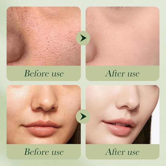 Avocado Facial Skin Care Sets & Kits, 4 pcs Skin Care Routine Kit For women, Skincare Products Set with Toner, Lotion, Eye Cream, Hydrating Skincare set for all skin types, Anti Aging facial kit.-Velvo Beauty