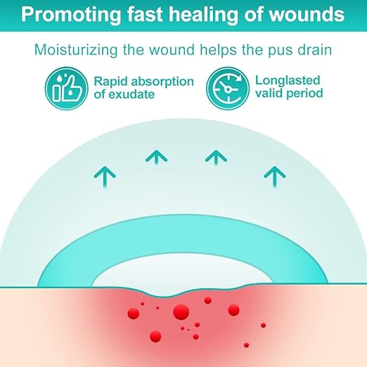 Dimora Hydrocolloid Dressing 4" x 4" for Wound Care, 10 Pack Large Patch Bandages with Self-Adhesive for Bedsore, Burn, Blister, Acne Care, Super Absorbent for Fast Healing-Velvo Beauty