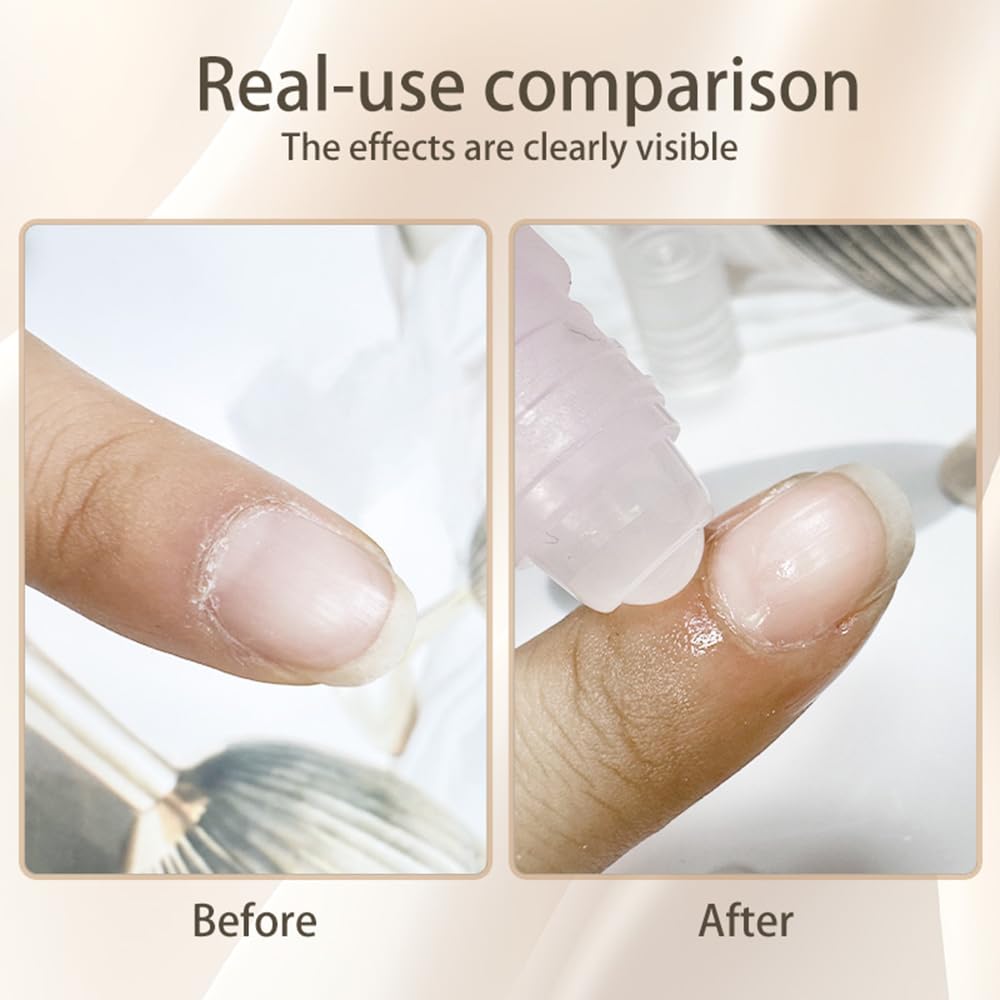 5pcs Cuticle Oil Roller Nourishing Moisturizing Roll On Cuticle Oil for Convenient Portable Nail Rollerball for On the Go Hydration and Care-Velvo Beauty