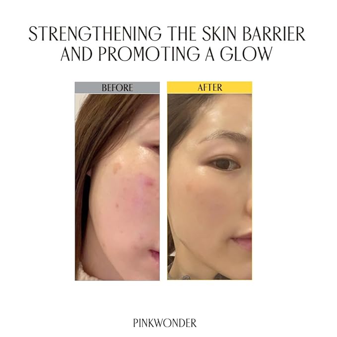 PINKWONDER Jojoba Vita Cream 3.38oz (100ml), Jojoba Oil and vitamin B12 Face Cream, Soothing for Sensitive Skin, Hypoallergenic, Korean Skincare-Velvo Beauty