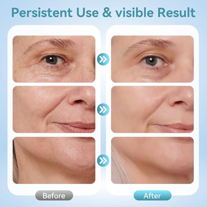 Neck Face Massager, 7-in-1 Portable Facial Massager for Enhanced Face, Neck and Shoulder Care with Vibrating and Warming Function，White-Velvo Beauty