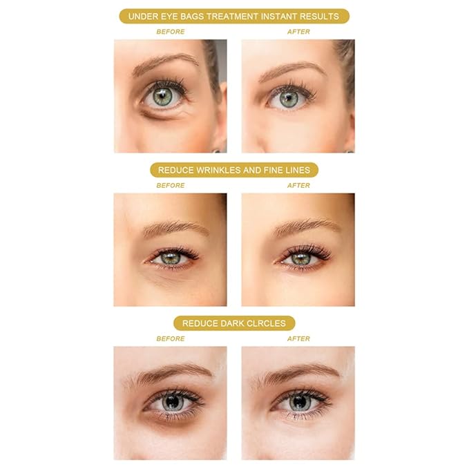 Under Eye Patches with Aloe Vera Natural for Dark Circles and Puffiness, Hyaluronic Acid Eye Mask 60 Pieces Moisturizing Skin Care for Anti-Wrinkle-Velvo Beauty