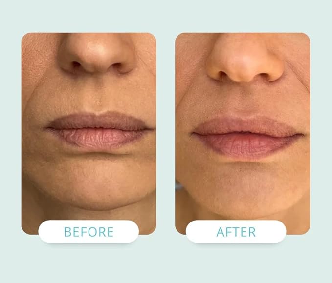 NADIA Lip Renewal Cream with NAD+ 10 ml / 0.34 fl oz (Made in USA)-Velvo Beauty