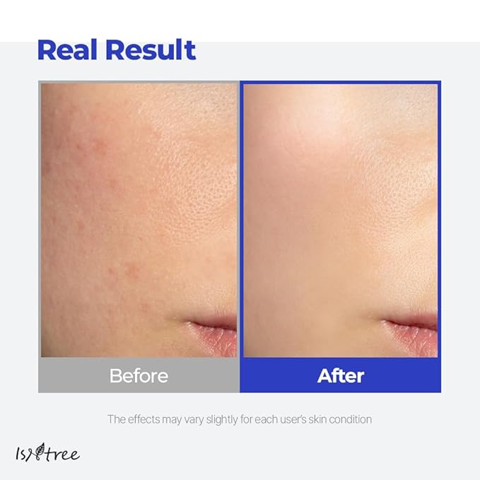 IsNtree Hyaluronic Acid Aqua Gel Cream 100ml, 3.38 fl oz | Korean Skincare | Lightweight Moisturizer | Quick-Absorbing Hydration | For Oily to Combination Skin-Velvo Beauty