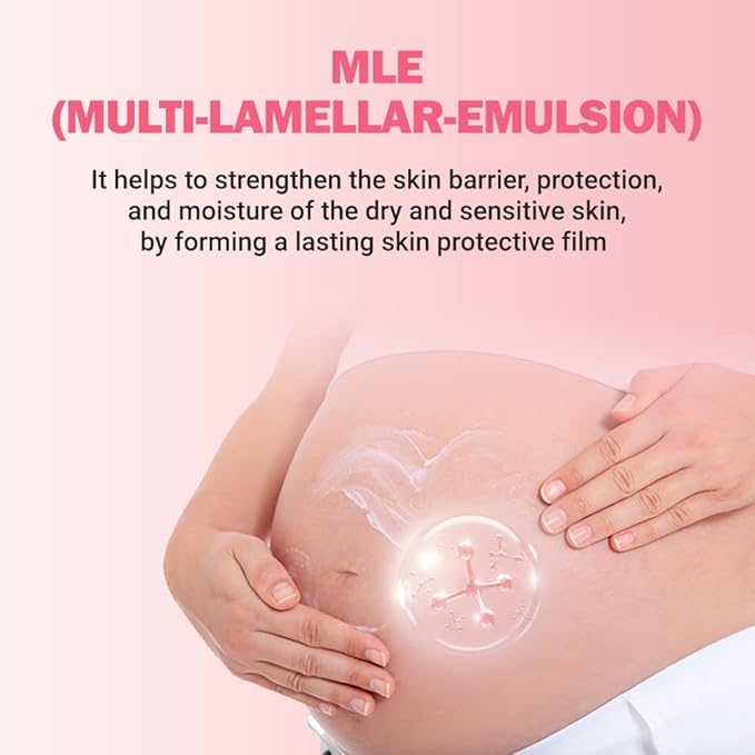 ATOPALM Maternity Care Stretch Mark Cream, 150ml 5 Fl Oz, Canola Oil Postpartum Skin Care| Pregnancy Red Lines Relief | Skin Swelling Elasticity Improvement| Gentle Body Moisturizing | Kbeauty-Velvo Beauty