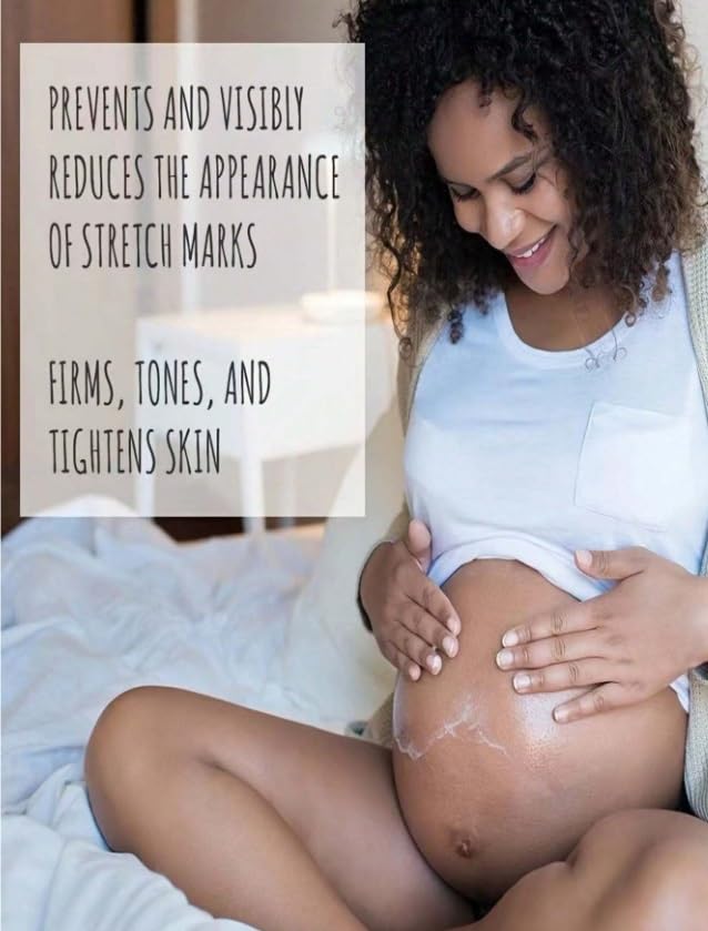 TRSTAY Stretch Mark Treatment Stretch Mark Cream (50, Grams)-Velvo Beauty