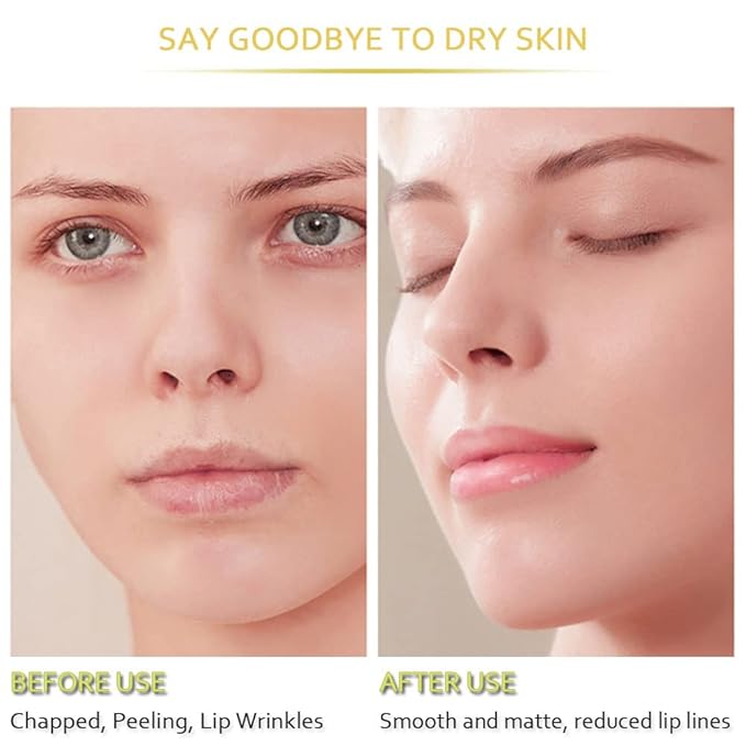 20Pcs Moisturizing Lip Mask, Restores Moisture Lip Care Mask for Dry Lips and Lip Lines Lips Overnight Lip Care, Gel Treatment Lip Masks Plumping Lips Mask (Yellow)-Velvo Beauty