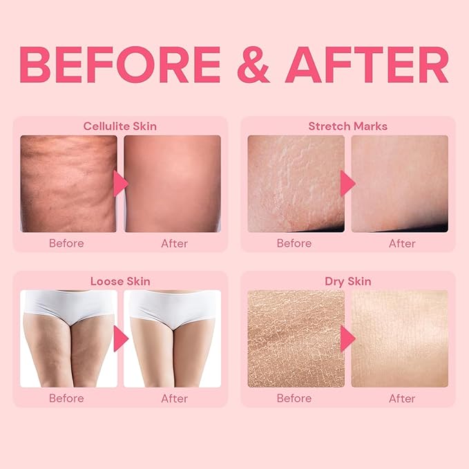 Anti Cellulite Body Firming Cream: Cellulite Remover for Legs & Inner Thigh- Skin Tightening Lotion for Womens' Booty, Stomach & Belly with Acetyl Hexapeptide-8 & Caffeine, 100 ML-Velvo Beauty