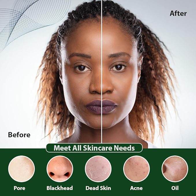 Facial Cleansing Brush | 3-in-1 Electric Face Scrubber | USB Rechargeable Face Cleansing Brush | IPX7 Waterproof | Blackhead Remover | Deep Cleansing & Exfoliating (Green)-Velvo Beauty