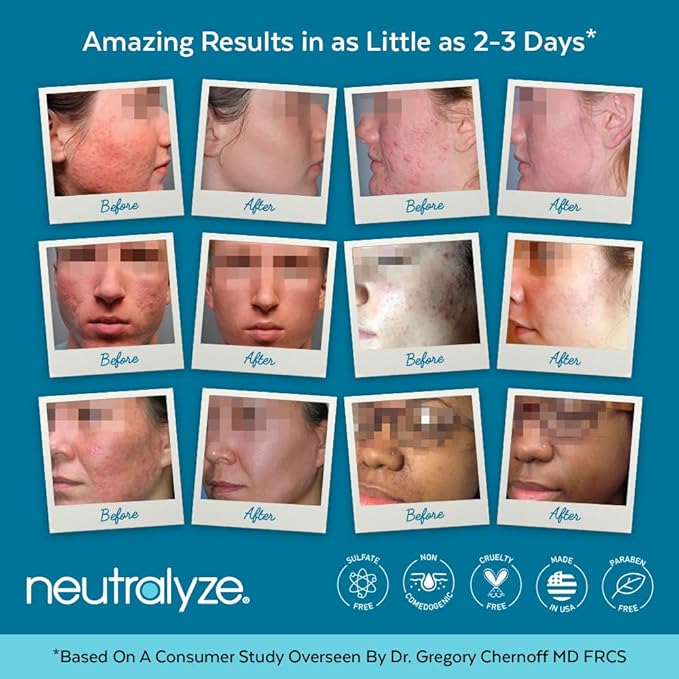 Moderate To Severe Acne Treatment Kit 2.0 (Clearing Serum & Synergyzer)-Velvo Beauty