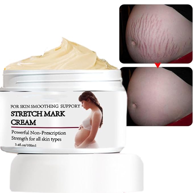 Stretch Mark Prevention Cream for Pregnancy, Stretch Mark Cream Remover, Stretch Mark Lotion for Pregnancy, Tummy Butter for Stretch Marks Pregnancy, Shea Butter Stretch Mark Removal Cream-Velvo Beauty