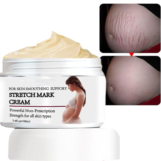 Stretch Mark Prevention Cream for Pregnancy, Stretch Mark Cream Remover, Stretch Mark Lotion for Pregnancy, Tummy Butter for Stretch Marks Pregnancy, Shea Butter Stretch Mark Removal Cream-Velvo Beauty