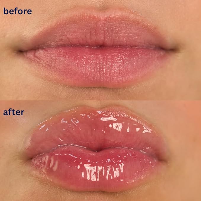 Endless Skin - Daydream - Natural Vanilla Flavor Lip Balm with Jojoba Oil, Hyaluronic Acid and Squalane - Ultra Glossy Finish that Nourishes and Hydrates Your Lips - Vegan and Paraben Free - 15ml-Velvo Beauty