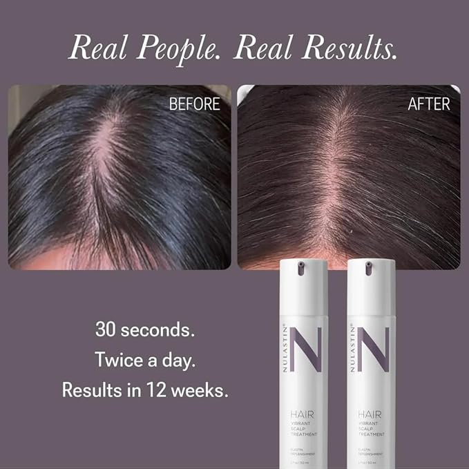 NULASTIN Hair Serum - HAIR Vibrant Scalp Treatment - Promote Scalp Care & Thicker Looking Volume in Thinning Hair - With Keratin & Peptides to Help Minimize Visible Shedding (1.7 Oz)-Velvo Beauty
