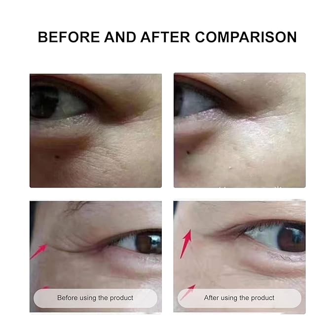 Under Eye Mask Wrinkle Patches, Under Eye Mask Amino Acid & Collagen,Eye Masks for Dark Circles and Puffiness,Eye Wrinkle Pads & Patches-Velvo Beauty