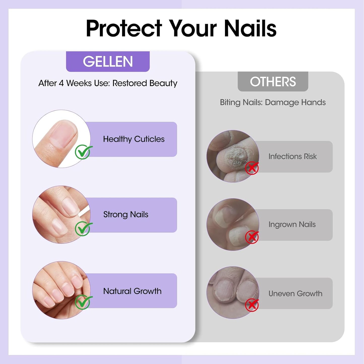 Gellen Nail Biting Treatment for Kids & Adults, Roll-On Stop Thumb Sucking Deterrent, 10ml Nail Biting Prevention, Quick Dry & Water-Resistant No Bite Nail Polish, Nail Care Solution-Velvo Beauty