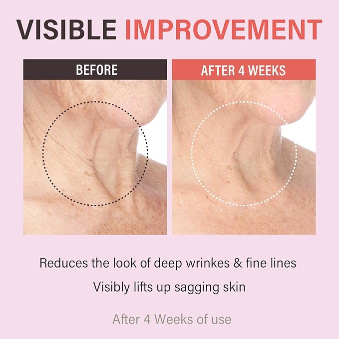 Retinol Collagen Lifting Neck Cream,Anti Aging Face and Neck Cream for Reduce Wrinkles and Hydrating & Lifting Neck,For Face, Neck, Décolleté Wrinkle Care, 1.76 oz.-Velvo Beauty