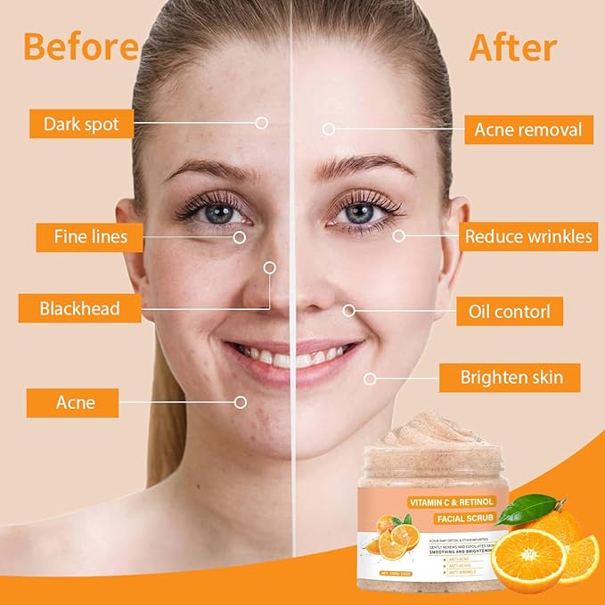Vitamin C Face Scrub, Exfoliating Facial Wash with Retinol, Facial Scrub,Facial Exfoliating Scrub, Facial Scrubs for Women,Deep Cleansing Face Wash Cleanser for Women Men-Velvo Beauty