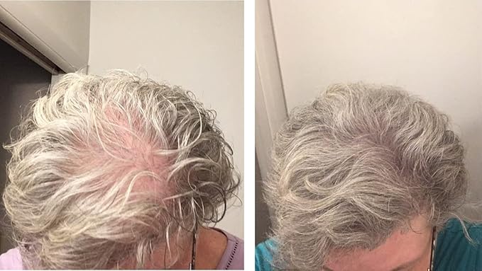 Hair Loss Concealer. Covers Bald Spot And Makes Thin Hair Look 10X Fuller Instantly. All-Natural Hair Building Fiber. Trial Size, 10-Day Supply. Gray-Velvo Beauty