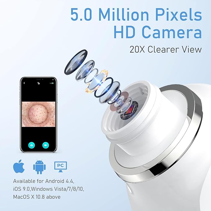 Facial Pore Blackhead Remover Vacuum, 1080P Camera Blackhead Remover, 20x Zoom, 8 LEDs ＆ 3 Suction Modes, 800mAh Battery & USB - 6 Heads Pore Cleaner Kit for Women&Men(Orange)-Velvo Beauty