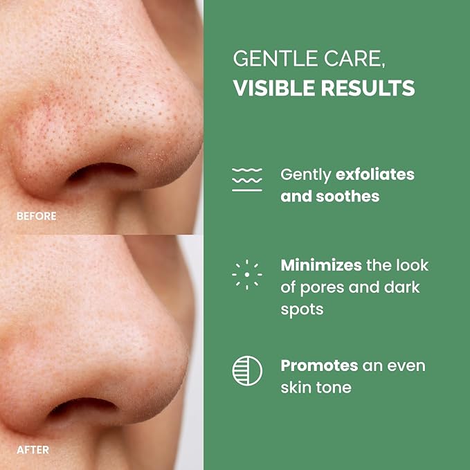 PLANTIFIQUE Korean Glycolic Acid Toner Pads 60 Pcs with Niacinamide, CICA - AHA BHA PHA Face Daily Peel Exfoliating Pads Formula for Gentle Skin Renewal for All Skin Types - Refillable Container-Velvo Beauty