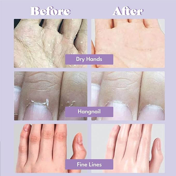 Catherine Muller Floral Hand Mask 8 Pairs, Moisturizing Gloves for Dry Hands with Elder Flower & CICA, Repairing and Nourishing Hand Care Treatment for Cracked, Rough, and Dry Skin-Velvo Beauty