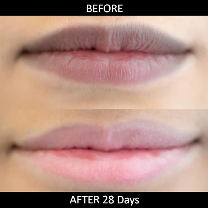 Omorfee 100% Organic Lip Lightening Stick for Dark Lips, Lip Whitening Lipstick with SPF, Natural Lip Balm Protection & Repair, Cocoa Butter, Carrot Seed Oil & Pineapple Extract - 6 Grams/0.21 Oz-Velvo Beauty