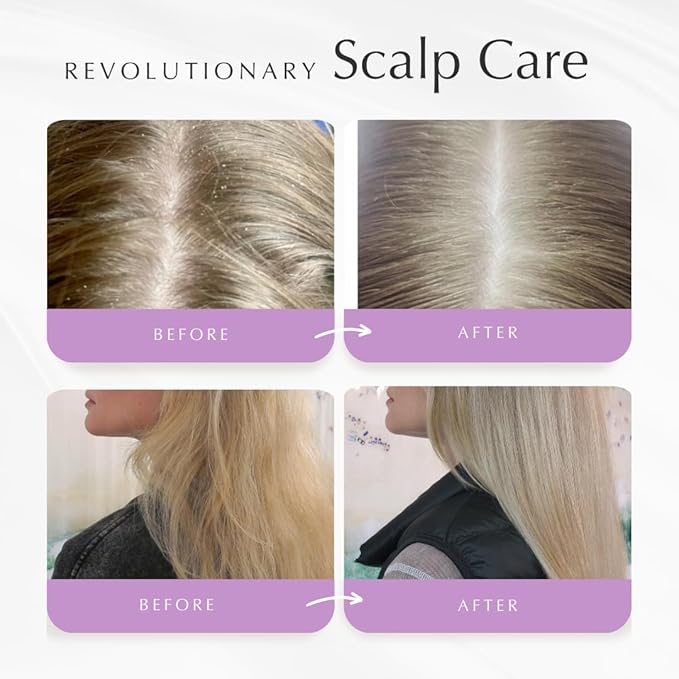 Citrus Cider Whip Hair Plaster | Vitamin C Infusion for Radiant Hair | Fruit Butters, Orange Peel Serum, Argan & Coconut Oils | Transform Damaged Hair Into Silky Mane-Velvo Beauty