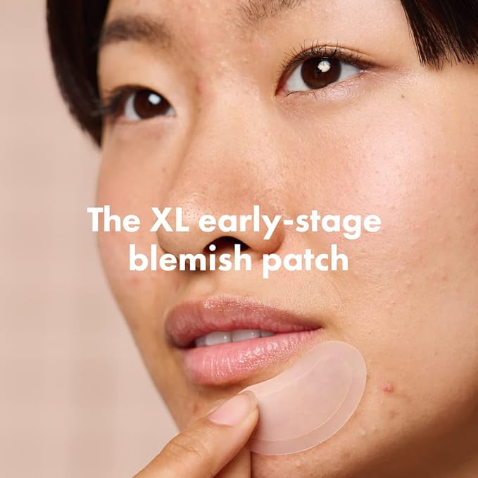 Mighty Patch Micropoint Large Hydrocolloid Pimple Patches for Face Blemishes from Hero Cosmetics, Acne Stickers for Early Stage Zits & Hidden Pimples, 1,385 Proprietary Micropoints, 6 Count-Velvo Beauty