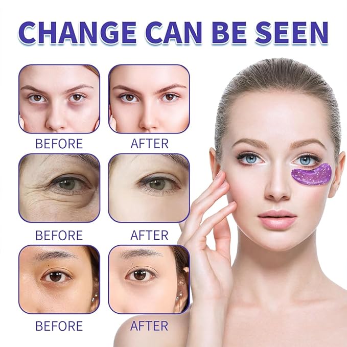 28 Pairs Under Eye Patches, Natural Collagen Eye Patches for Puffy Eyes, Under Eye Mask Patches for Face, Reduce Dark Circles, Fine Lines and Puffiness, Refreshes Your Skin, Eye Moisturizer Treatment-Velvo Beauty