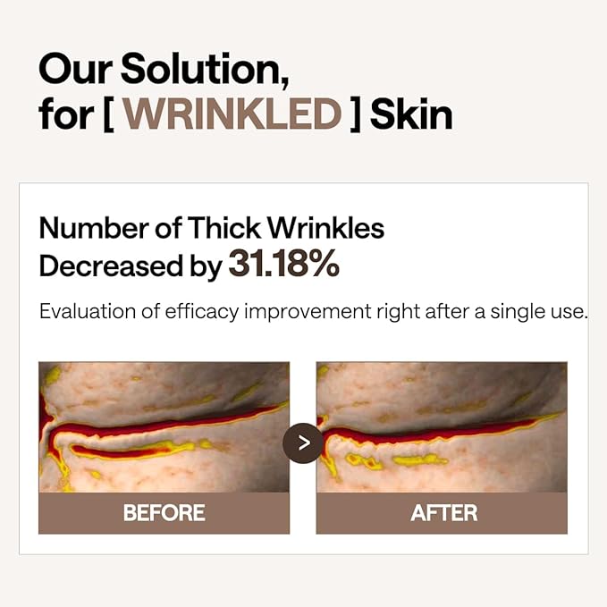 Mediheal Retinol Collagen Under Eye Patches - Korean Hydrogel Eye Pads (60 patches) with 95% Retinol & 5 Micro Collagen. Nourishing & Non Irritating Eye Gel Mask. Sealing Cap & Spatula Included.-Velvo Beauty