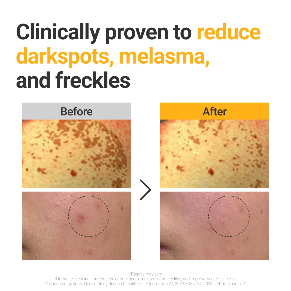 ROVECTIN Vita Dark Spot Serum for Clearing Blemish and Evening Skin Tone | Rich Vitamin C, Brightening, Hydrating For Dry, Sensitive, Normal, Oily Skin | Vegan K-Beauty (1.01 Fl. Oz, 30ml)-Velvo Beauty