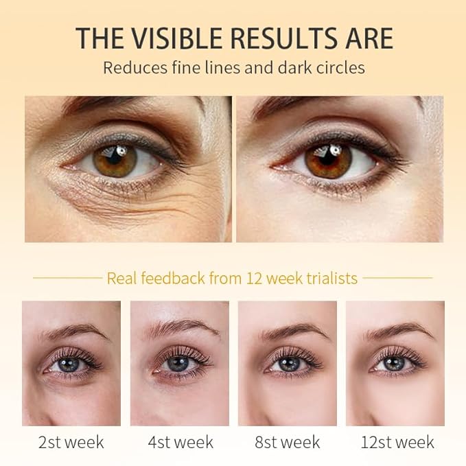 RtopR Mango Firming Eye Cream, Under Eye Cream for Dark Circles and Puffiness, Firm and Smooth the Look of Fine Lines, Smoothes the Skin Around the Eyes-Velvo Beauty