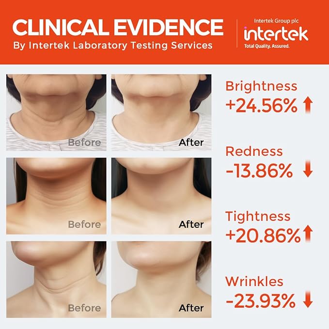 Neck & Décolleté Firming Beauty Device – LED Light Therapy Skin Tone and Texture Enhancement, 630nm and 830nm Dual Wavelengths Emission LED Device, Liquid Silicone-Velvo Beauty