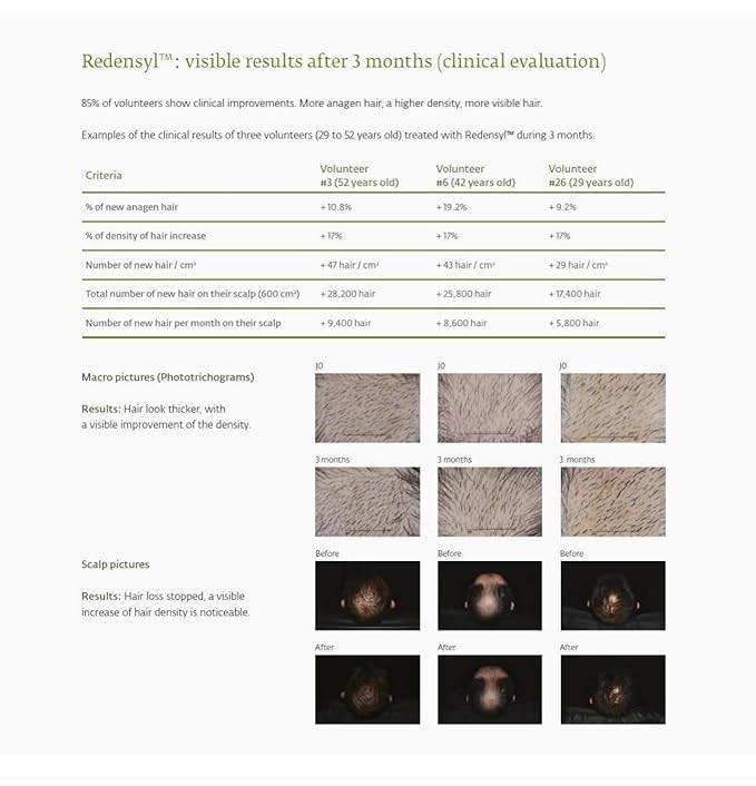 Avjou Researche™ Vitamin Mask – Supports the Look of Thicker, Fuller Hair – Vegan, Color & Keratin Safe, Hydrates & Strengthens with Redensyl™ – Designed for All Hair Types, 6 oz-Velvo Beauty