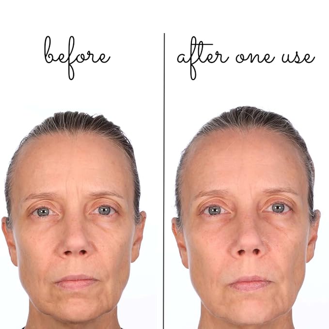 Consult Beaute Volumagen Miracle Plumping Barrier Balm - Facial Moisture Slugging - Overnight Deep Skin Hydration - Dry Skin - Hyaluronic Acid - Petrolatum Free - Lanolin Free - Mineral Oil Free 1 oz-Velvo Beauty