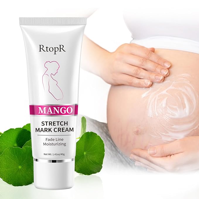 RtopR Mango Stretch Mark Cream for Pregnancy, Stretch Mark Repair Cream, Fade Line, Moisturizing and Non-Greasy, Safe to Use When Pregnant-Velvo Beauty