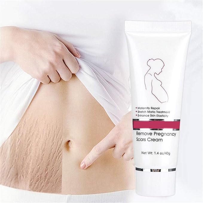 RtopR Stretch Marks and Scar Cream,Crema para Estrias De Embarazo,Stretch Marks Postpartum Repairing Cream Wrinkles Diluting Removal Cream Crema De Cacao para Cicatrices-Velvo Beauty