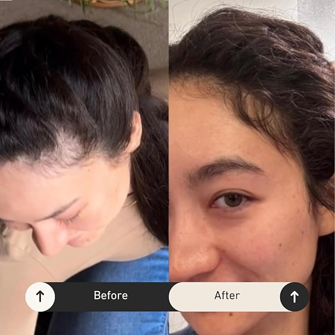 BUR BUR Growing Season Hair Growth And Repair Oil | With Burdock, Nettle Oil and Vitamin C for Visibly Fuller, Stronger and Shinier Hair.-Velvo Beauty