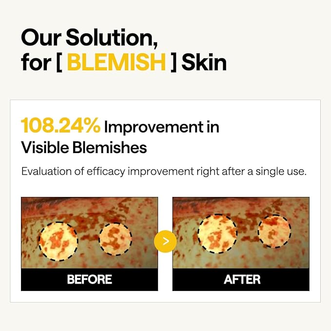 Mediheal Vita Collagen Under Eye Patches for - Korean Hydrogel Eye Pads (60 patches) with 7 Vitamin & 5 Micro Collagen. Moisturizng & Non Irritating Eye Gel Mask. Sealing Cap Included.-Velvo Beauty