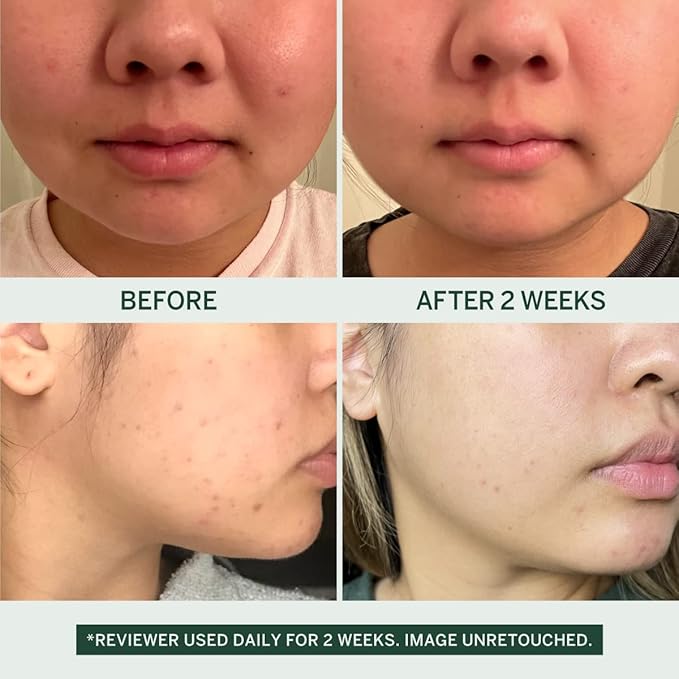 Urban Calm Discovery Bundle - Hydrating, Smoothing, Exfoliating, and Soothing Travel Size Skincare Set for All Skin Types - Fermented Skincare Products Include Cleanser, Essence, Serum, and Cream-Velvo Beauty