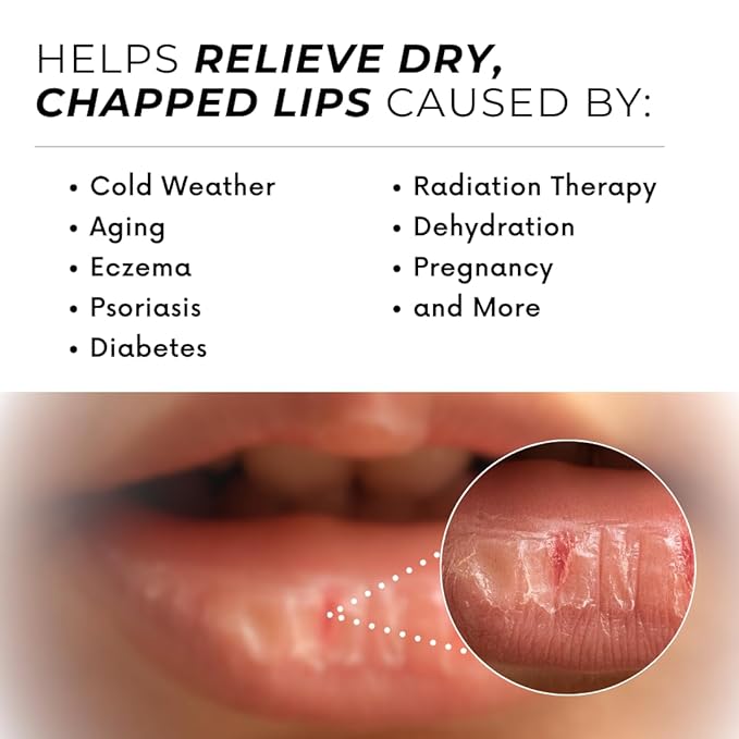 Natural Lip Balm For Very Dry Lips | Pack of 4 | Moisturizing Ghee, Shea Butter, Beeswax, Coconut Oil, & Jojoba Oil | Hydrating Lip Care For Chapped Lips, After Sun Care | Bioserene-Velvo Beauty