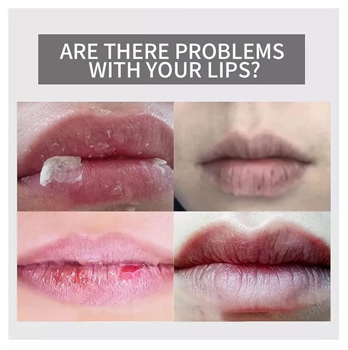 AICHUN BEAUTY Moisturizing Lip Balm Strawberry Smoother Dry Chapped Lips 50g/1.76oz-Velvo Beauty