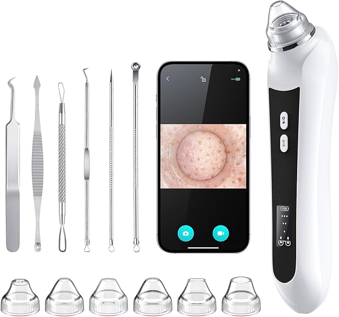 Facial Pore Blackhead Remover Vacuum, 1080P Camera Blackhead Remover, 20x Zoom, 8 LEDs ＆ 3 Suction Modes, 800mAh Battery & USB - 6 Heads Pore Cleaner Kit for Women&Men(Black)-Velvo Beauty