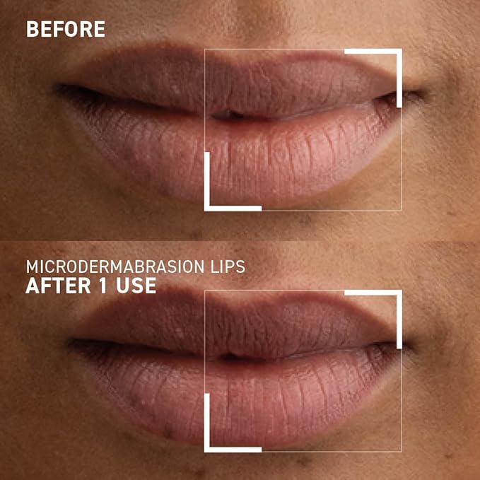 Dr. Brandt Microdermabrasion Smoothing Lip Scrub Gommage Lissant Levres 10 g / 0.35 oz-Velvo Beauty