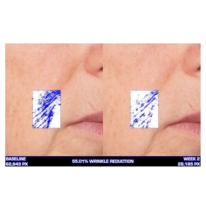 Serious Skincare Ultra-Mare Pure Marine Infusion Trio – Ultra-Mare Serum 1 oz, Ultra-Mare Facial Cream 2 oz. & Ultra-Mare Eye Cream .5 oz – Anti-Aging – Algae and Plankton extracts-Velvo Beauty